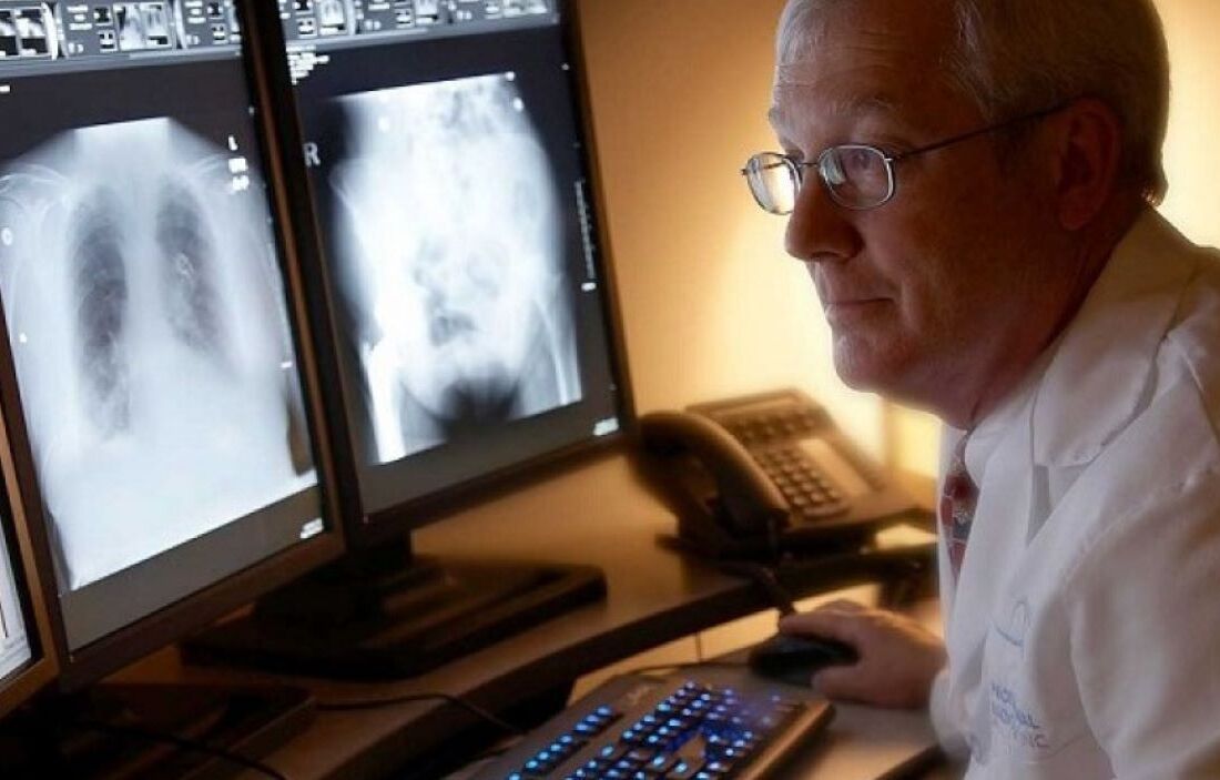 Doctor looking at x-rays